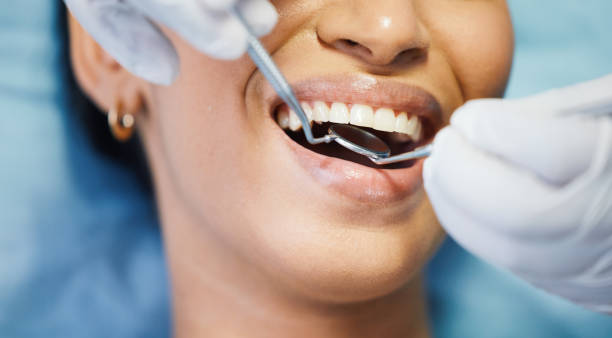 Best Emergency Dental Care for Abscessed Tooth in Silver Lake, FL